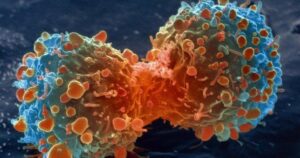 10 mitos populares do câncer (e por que eles estão errados)