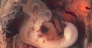 As 3 fases do desenvolvimento intra-uterino ou pré-natal: do zigoto ao feto


