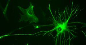 Astrócitos: quais funções essas células gliais desempenham?


