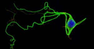Potencial de membrana em repouso: o que é e como afeta os neurônios?



