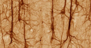 Quanto tempo vive um neurônio?